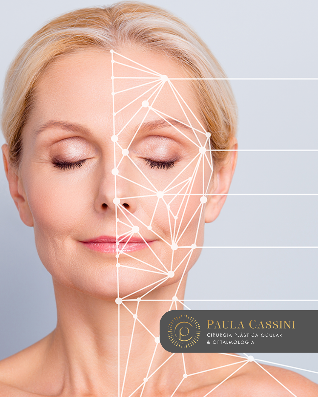 bioestimuladorespós-blefaroplastia